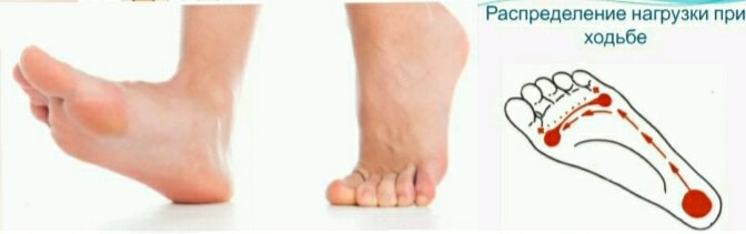  Наши стопы (в том числе пальцы ног и пальцы) играют огромную роль в сохранении здоровья всего тела.-9
