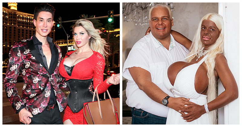 Клуб любителей апгрейда: как выглядят спутники жизни женщин, одержимых пластикой