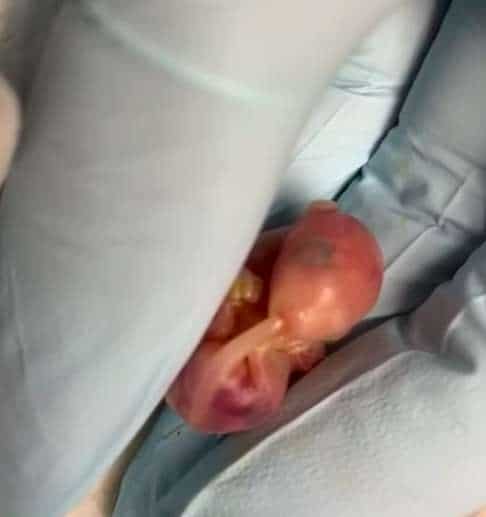 детёныш опоссума