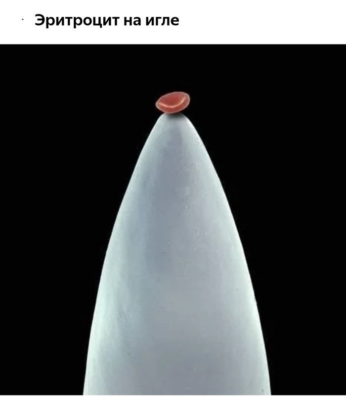 Невероятные фотографии под микроскопом 