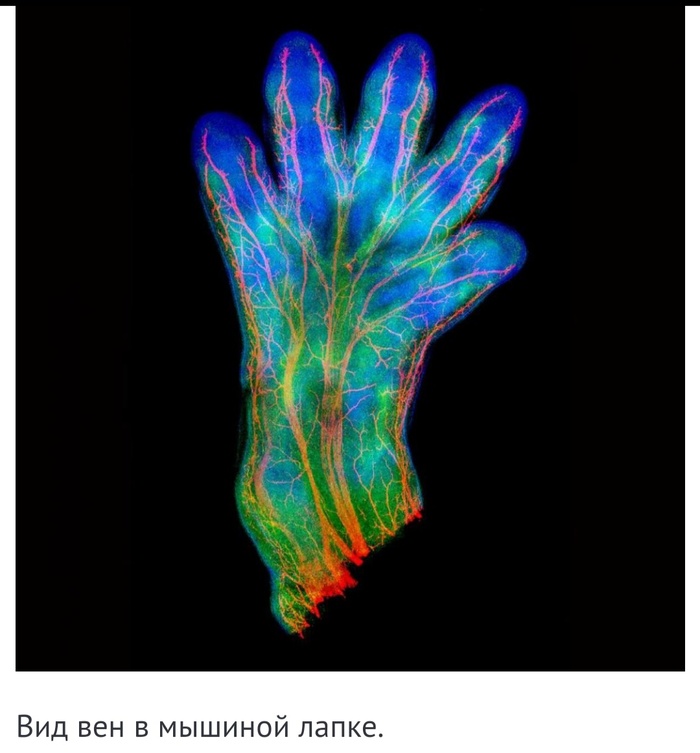 Невероятные фотографии под микроскопом 