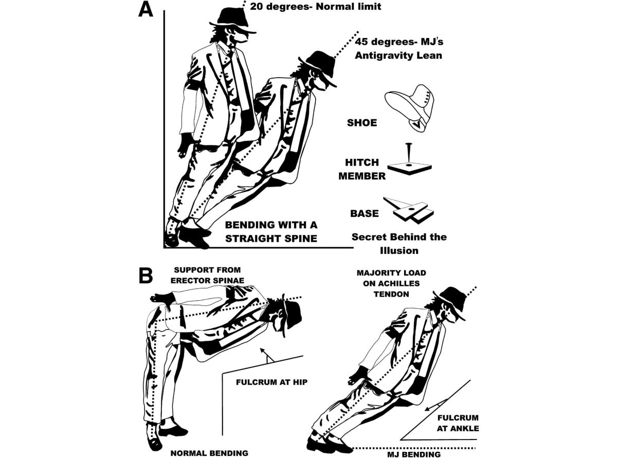 Механизм наклона / © Journal of Neurosurgery: Spine