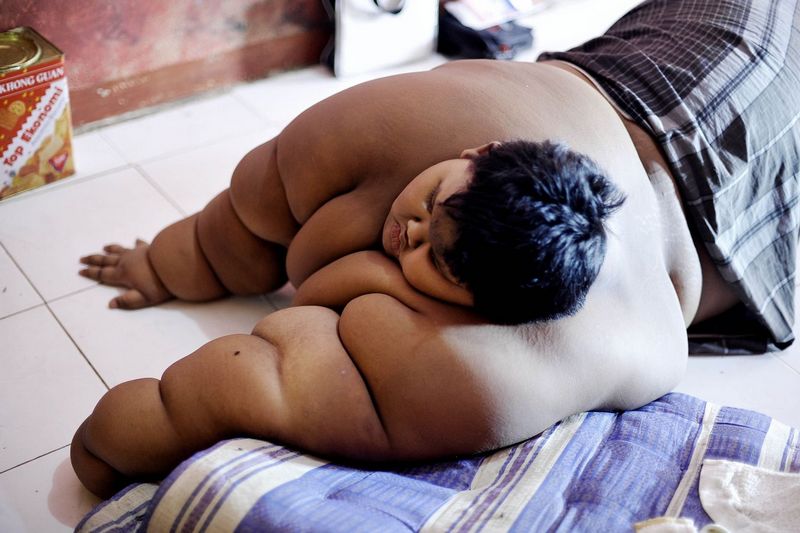 Самый тяжелый ребенок в мире похудел