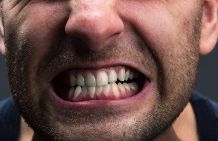 Почему люди скрипят зубами во сне и что с этим делать? болезни человека,здоровье и медицина,здоровье человека,технологии для лечения