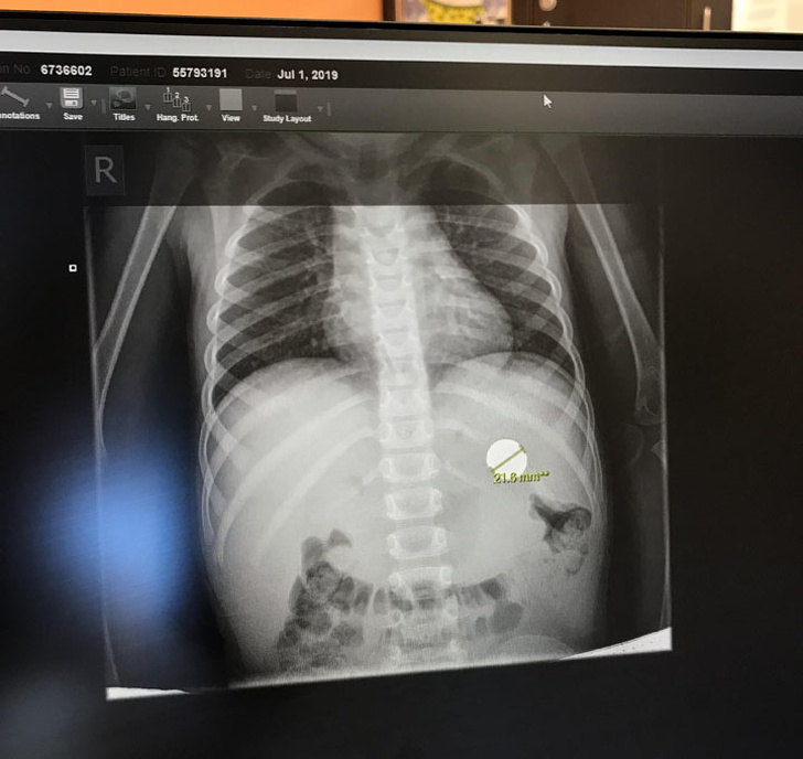 Чтобы быть родителем, нужна стальная выдержка, и вот 20+ доказательств этому Чтобы быть родителем, нужна стальная выдержка, и вот 20+ доказательств этому воспитание,Дети,Жизнь,Истории,Отношения,проблемы