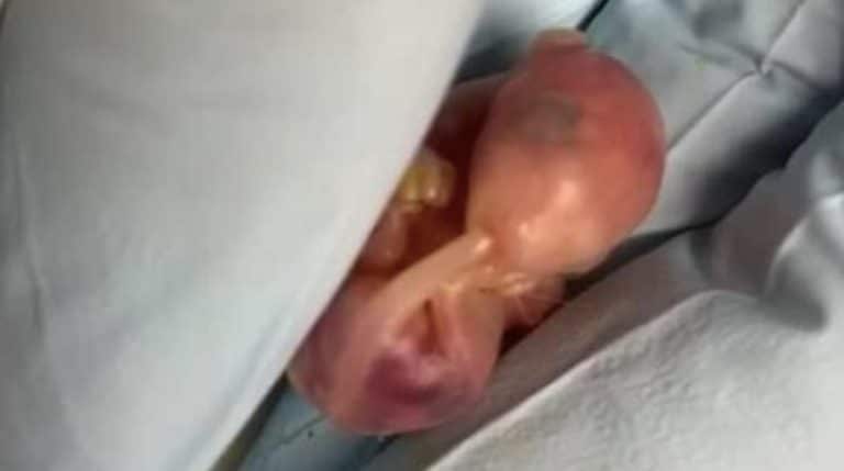 BeFunky-collage (12)