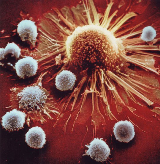 Наша невероятная иммунная система - микрофотографии чтобы, синего, системы, который, иммунной, клетки, Geographic, National, захватить, клетка, Тклетки, Boehringer, которая, система, иммунная, псевдоподия, называется, потянулся, бактерию, Человеческое