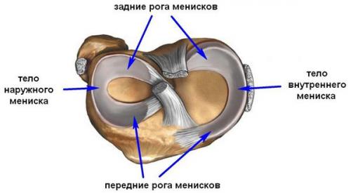 Мениск колена поврежденный. Этиология 02