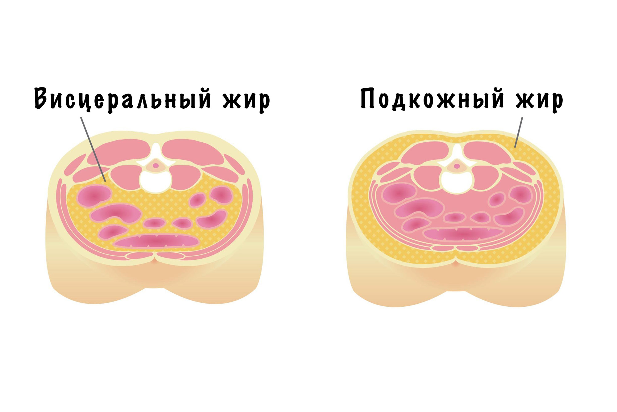 Висцеральный жир — что это?