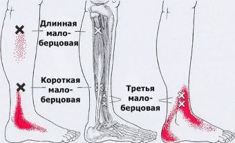 Карта точек боли в теле и точек напряжения мышц (триггеры)