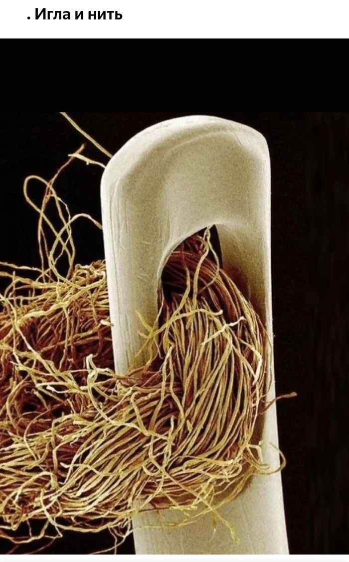 Невероятные фотографии под микроскопом 