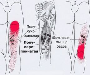 Карта точек боли в теле и точек напряжения мышц (триггеры)