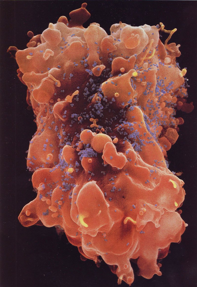 Наша невероятная иммунная система - микрофотографии чтобы, синего, системы, который, иммунной, клетки, Geographic, National, захватить, клетка, Тклетки, Boehringer, которая, система, иммунная, псевдоподия, называется, потянулся, бактерию, Человеческое