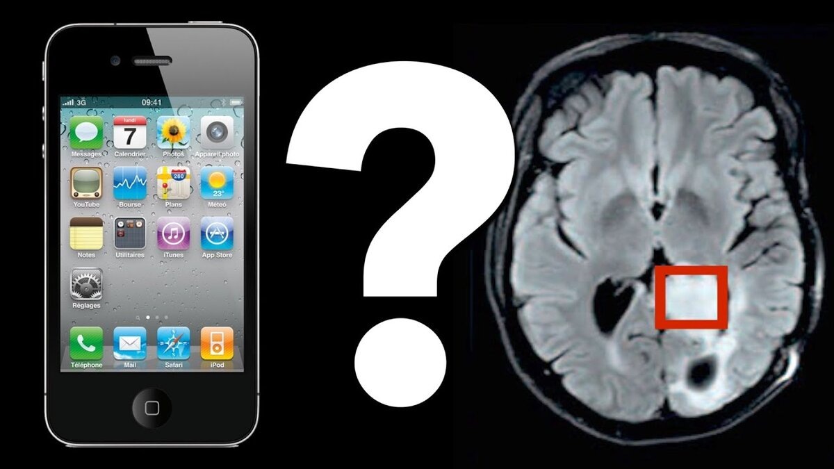 Как воздействует мобильный телефон на мозг