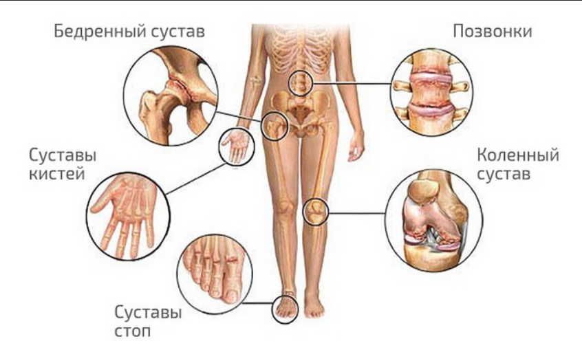 Лечение ревматизма народными методами: спасительные травы придут на помощь!