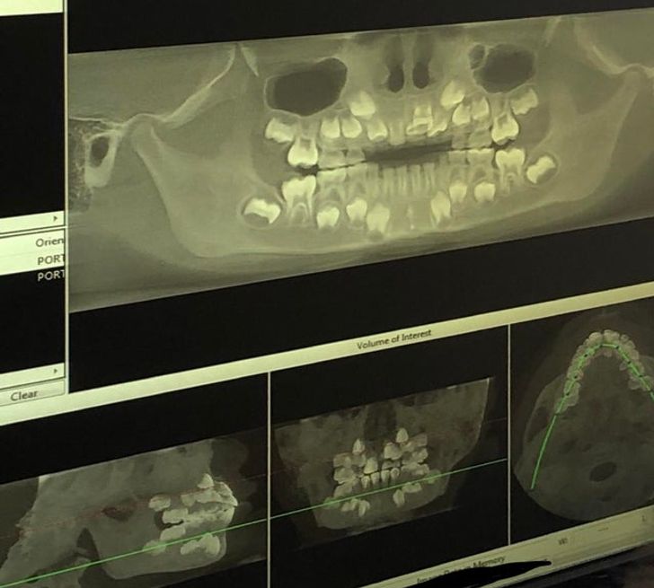 15 рентгеновских снимков, которые показывают скрытые стороны нашей жизни интересное,медицина,рентгеновские снимки