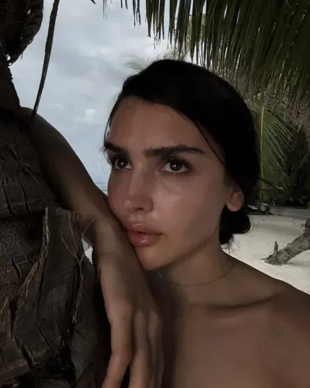 Дина Саева перенесла операцию на носу instagram (инстаграм),социальная сеть,Алессандра Амбросио,Виктория Боня,виктория лопырева,Дина Саева,Никита Ефремов,федеральная служба по финансовому мониторингу (росфинмониторинг)