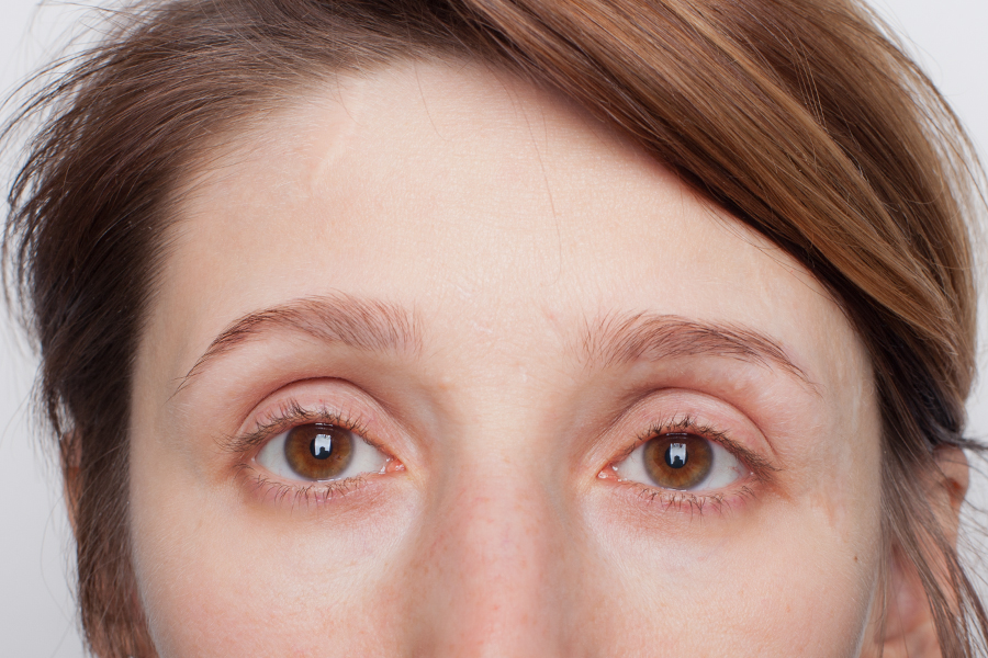 женщина с большими глазами. поднятые вверх брови. девушка без макияжа. приподнятые брови. креативы реклама брови.