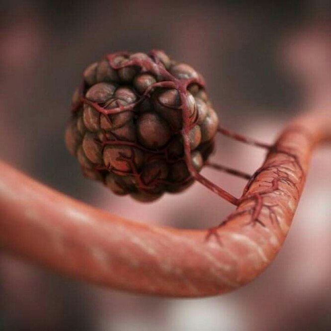 Рак: как он возникает, почему так тяжело лечится и можно ли не допустить его развития? клетка, клетки, человека, организма, организм, человек, опухоли, этого, чтобы, Когда, опухоль, становится, жизнь, способы, для организма, когда, внутри, перестает, программа, мутации