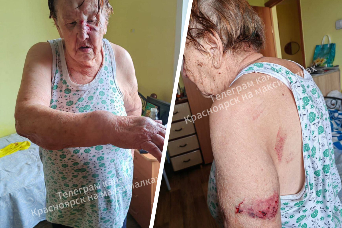 Постояльцы избили 89-летнюю красноярку в пансионате «Ветеран»