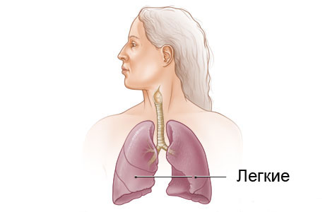 Инфекционные болезни: вторичный туберкулез болезни,здоровье,медицина,туберкулез