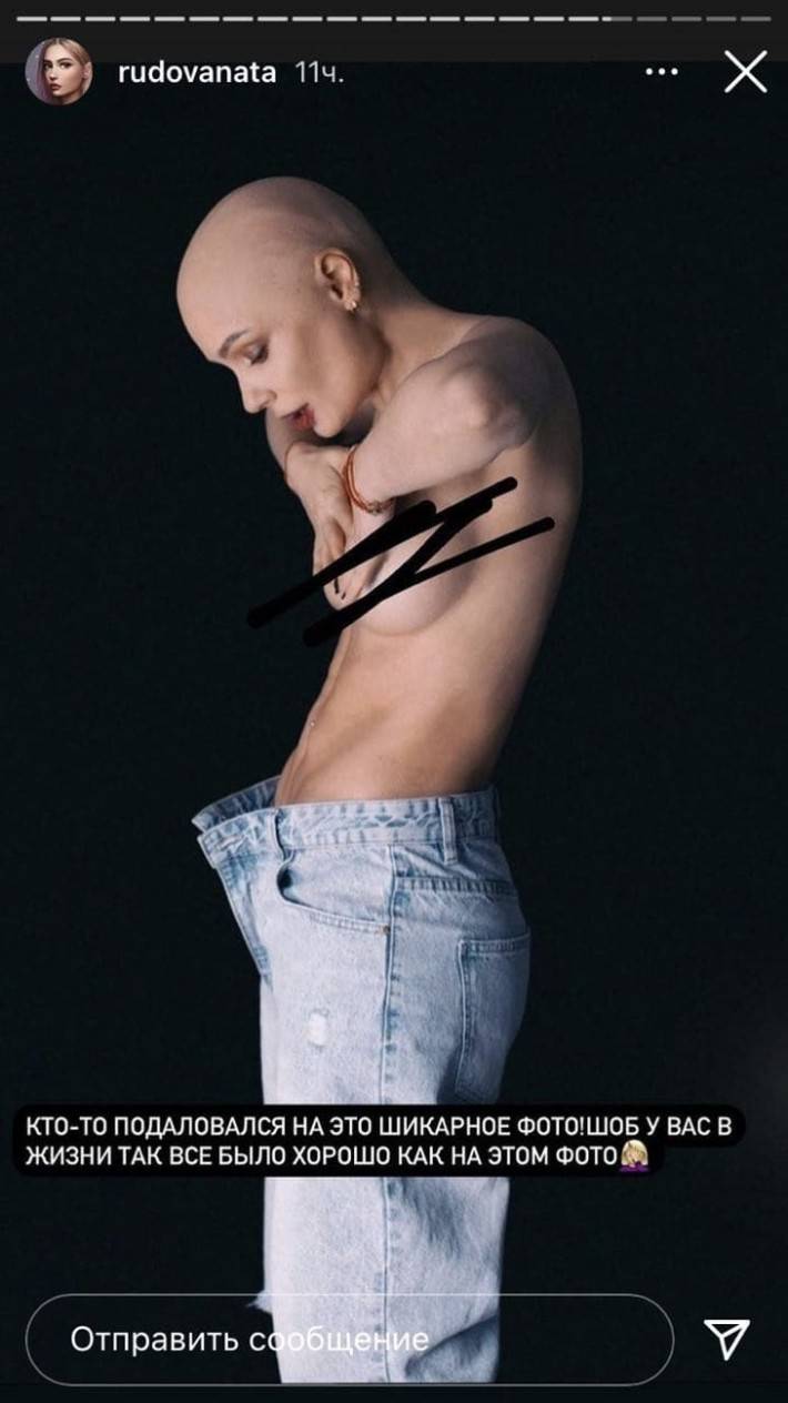 Лысая Наталья Рудова нарвалась на гнев поклонников из-за экстравагантного фото Шоу-бизнес