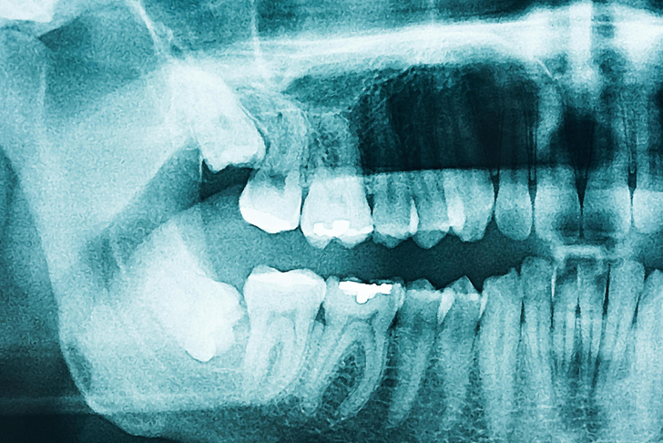 Зачем в зубах нервы? анатомия,наука,физиология