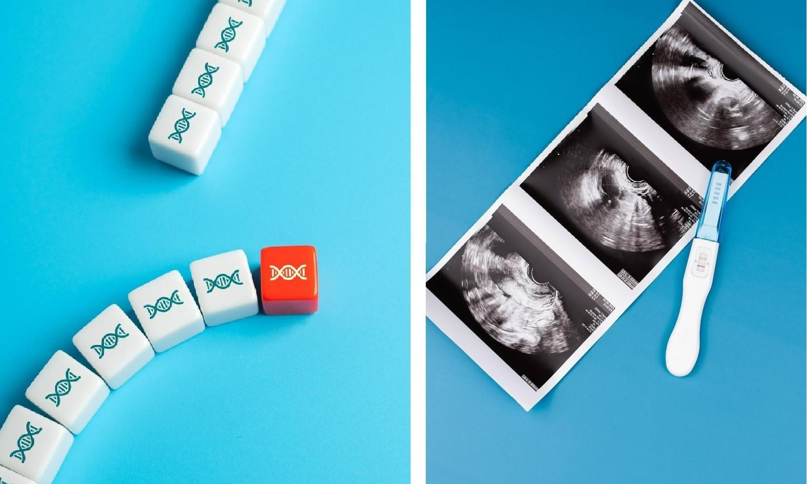 Три уникальных генетических заболевания, которые делают ребенка бесплодными и выявляются очень поздно