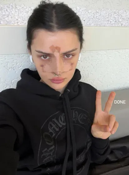 Дина Саева перенесла операцию на носу instagram (инстаграм),социальная сеть,Алессандра Амбросио,Виктория Боня,виктория лопырева,Дина Саева,Никита Ефремов,федеральная служба по финансовому мониторингу (росфинмониторинг)