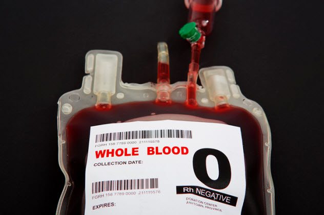 Любопытное о переливании крови