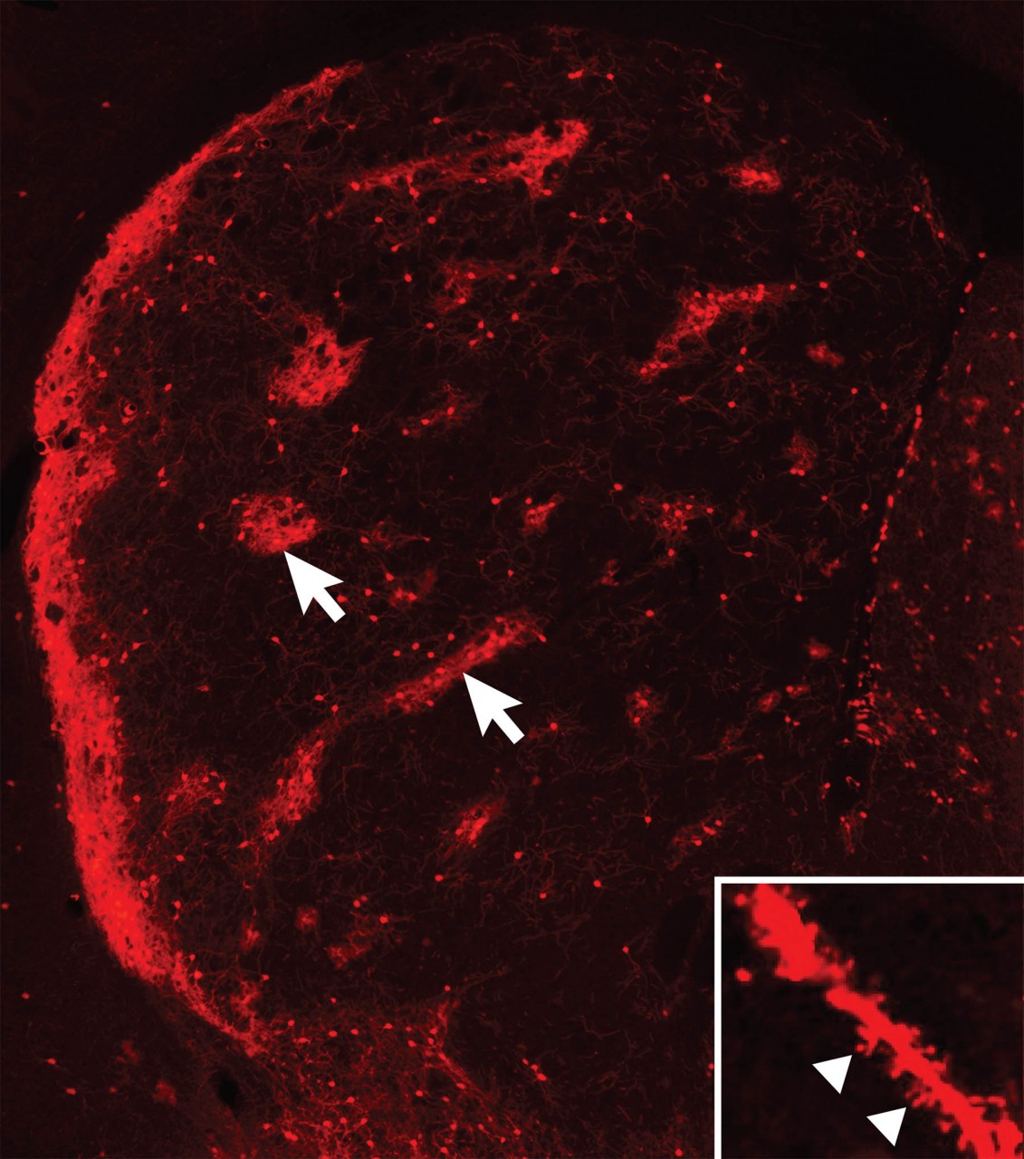 Нейроны, родившиеся в ганглионарном бугорке от клеток-предшественников второго порядка, первыми мигрируют в место, которое позже станет зрелым полосатым телом. На этом изображении они выглядят, как красные «островки» в более тёмном «море»