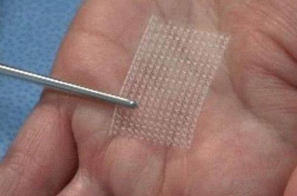 Что теперь сможет сделать с вашим телом пластический хирург Что теперь сможет сделать с вашим телом пластический хирург красота,пластическая хирургия,технологии