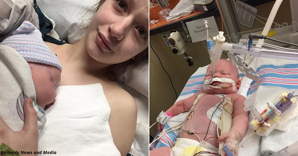 Новорождённая малышка умерла из-за поцелуя кого-то из друзей: герпес съел ее лёгкие и мозг