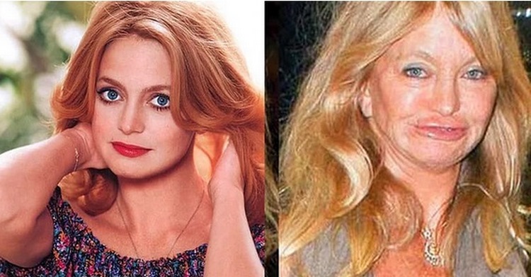 Старость беспощадна: 15 знаменитостей, которых изменил возраст Старость беспощадна: 15 знаменитостей, которых изменил возраст