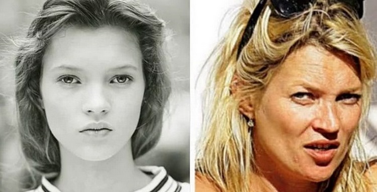 Старость беспощадна: 15 знаменитостей, которых изменил возраст Старость беспощадна: 15 знаменитостей, которых изменил возраст