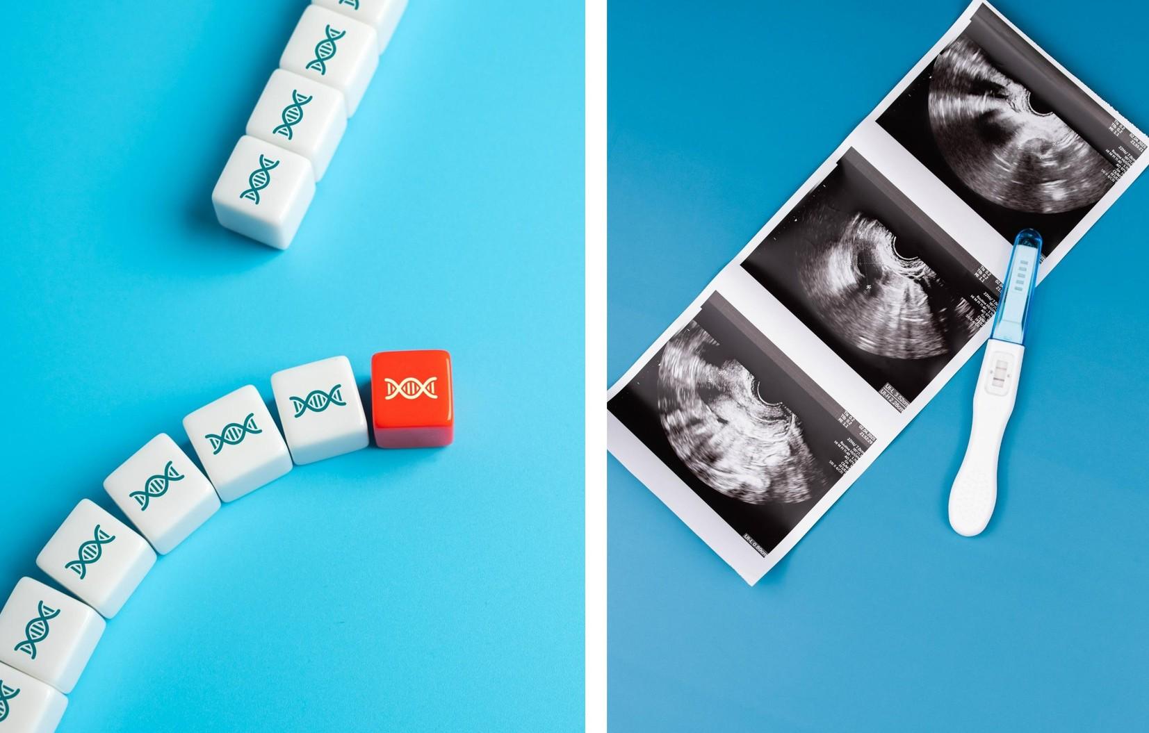 Три уникальных генетических заболевания, которые делают ребенка бесплодными и выявляются очень поздно ребенка, ШерешевскогоТернера, Клайнфельтера, Джейкобса, синдроме, могут, возрасте, хромосом, только, жизни, половых, можно, которые, никак, эксперт, синдромах, встречается, ранних, Однако, внешне