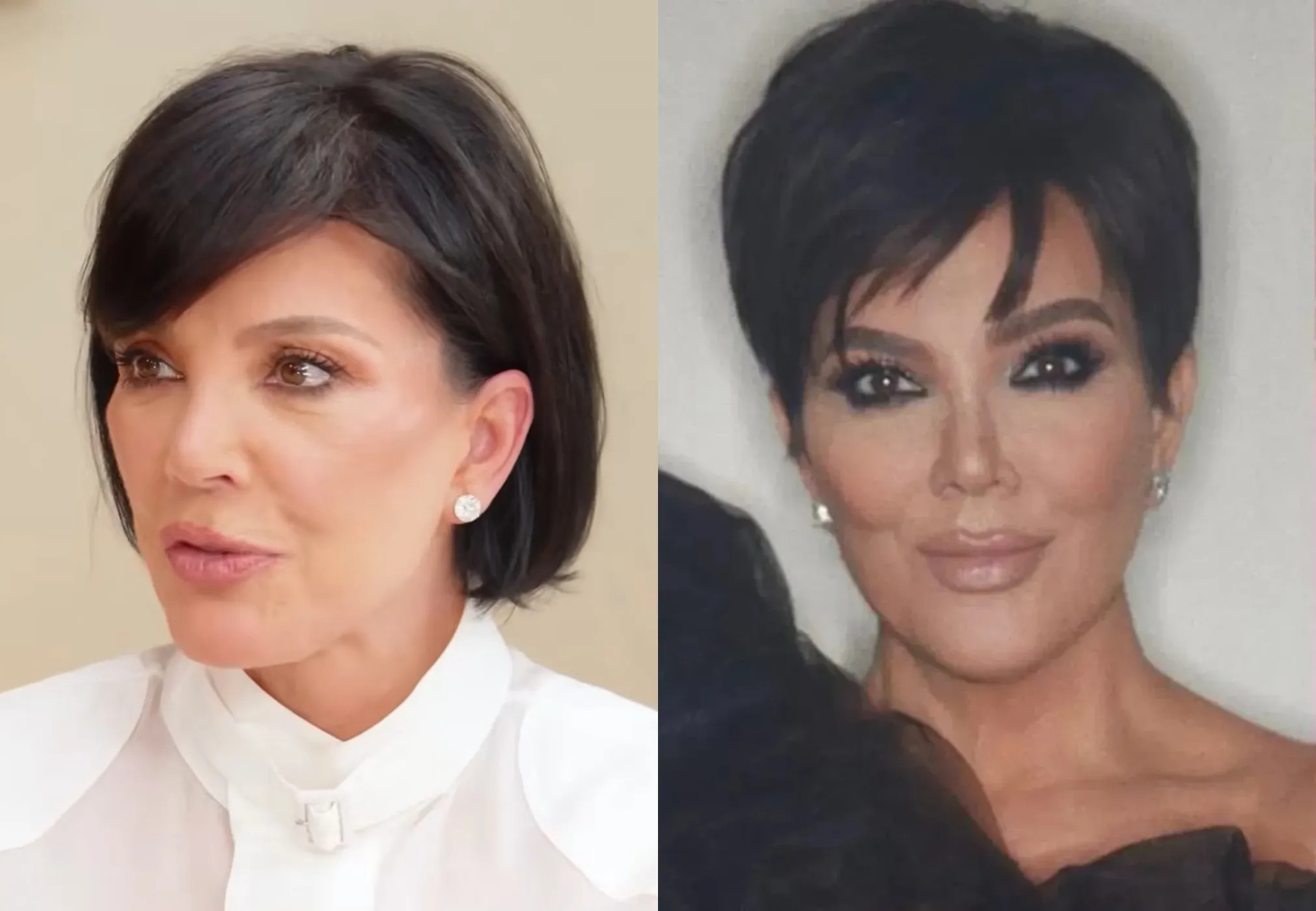 "В 70 лет мне уже всё равно". Крис Дженнер ответила на критику её подтяжки лица