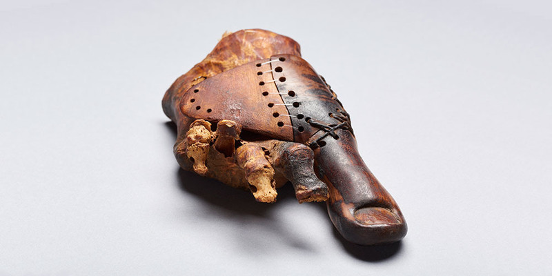The prosthetic toe.