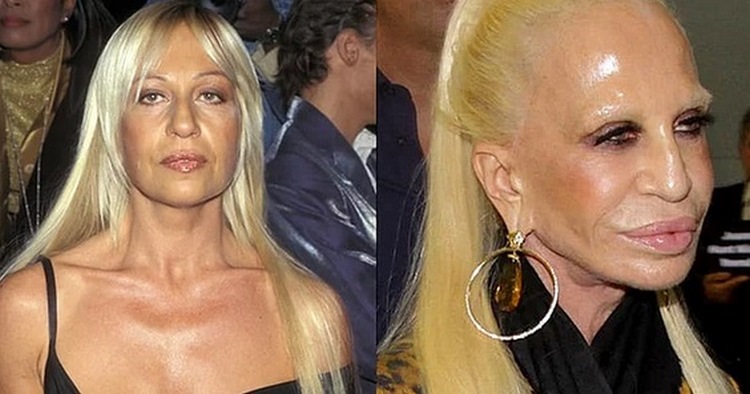 Старость беспощадна: 15 знаменитостей, которых изменил возраст Старость беспощадна: 15 знаменитостей, которых изменил возраст