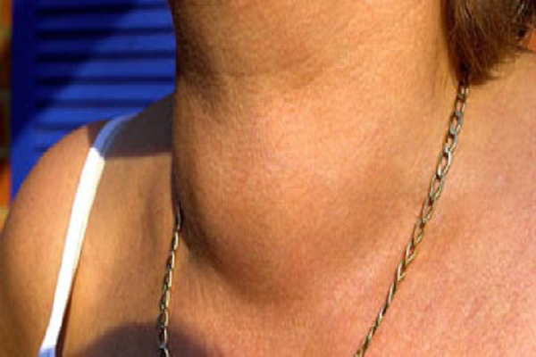 what-destroys-your-thyroid-gland-and-how-to-treat-it-with-this-recipe3