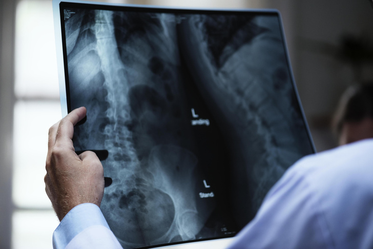 Сила просвещения: как служат медицине рентген, КТ и МРТ