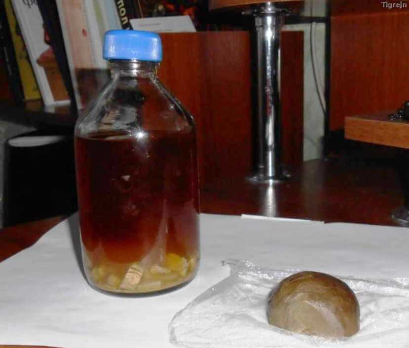 12 лет язвой мучился, пока не нашел свое средство лечения. С 1994 года забыл о болезни вообще!