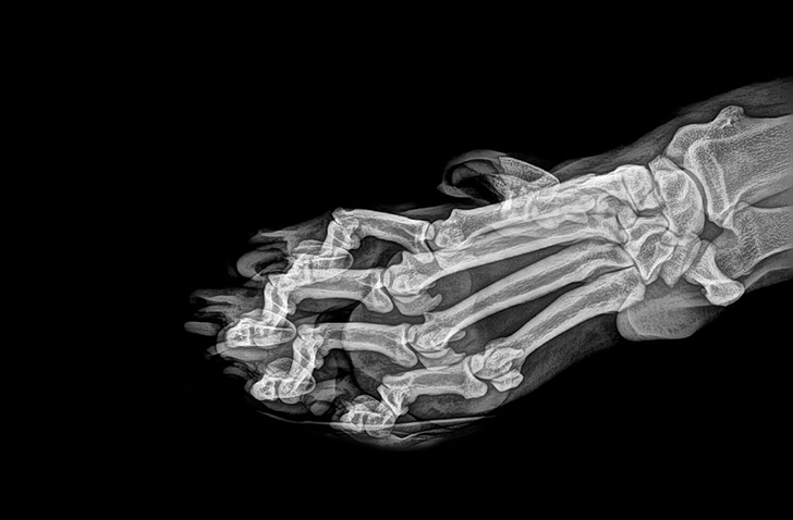 15 рентгеновских снимков, которые показывают скрытые стороны нашей жизни выглядит, рентгеновскими, RedditТак, снимок, снимке, которые, ящерицы, PikabuРентген, мозга© Ryabkov, головного, RedditАртерии, на ноге© Encantalasmontaas, косточка, та самая, на рентгене, лучами© DragonsExMachina, Рентгеновские, еж под, геккон, TwitterА вы когданибудь