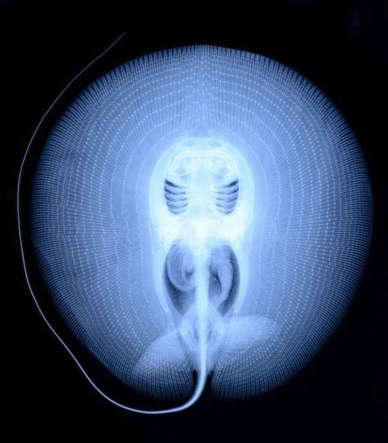 Рентгеновский снимок ската. земля, природа, удивительные фотографии