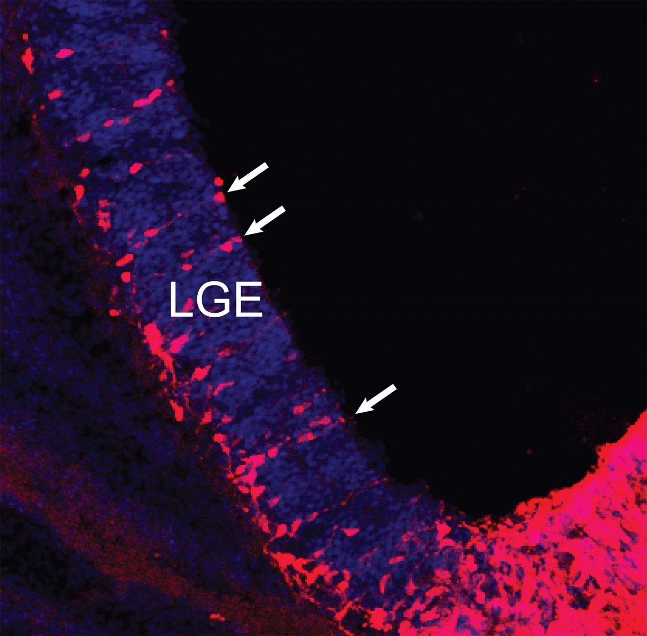Нейроны, которые заселят полосатое тело, рождаются в латеральном ганглионарном бугорке (lateral ganglionic eminence, LGE) и начинают мигрировать. Клетки-предшественники нейронов (отмечены белыми стрелками) располагаются вблизи базальной мембраны бугорка. Они дают начало «нитям» созревающих нейронов, которые перемещаются в развивающееся полосатое тело. Позже эти нейроны сформируют там «островки» стриосом