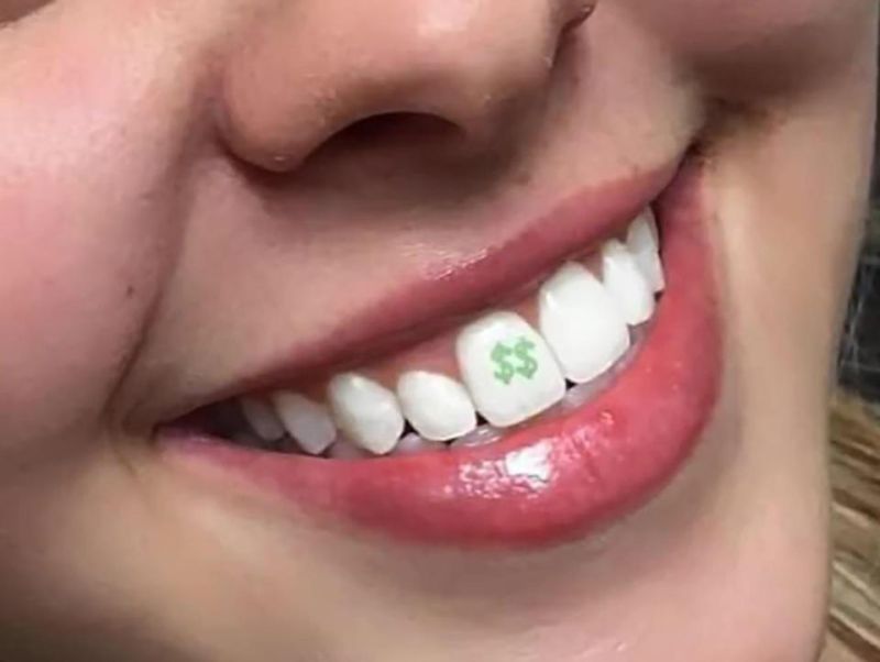 Набирает популярность новый тренд: тату на зубах