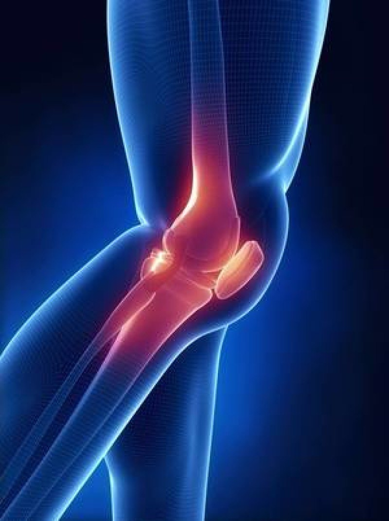 Киста Бейкера – что это, как обнаружить и лечить? боль в коленях,грыжа,здоровье,киста,киста бейкера,колено,медицина