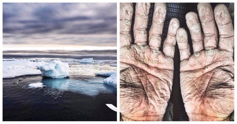 Так выглядят руки олимпийского чемпиона, покорившего Северный Ледовитый океан Северный Ледовитый океан, вода, люди, руки, спорт, чемпион