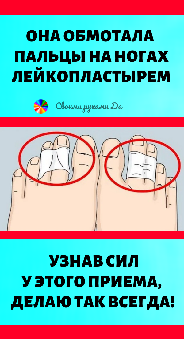 Она обмотала пальцы на ногах лейкопластырем. Узнав силу этого приема, делаю так всегда!