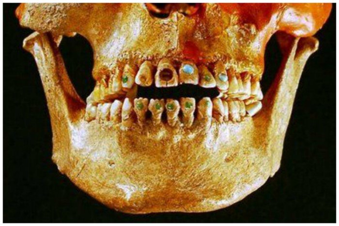 Что делали стоматологи прошлого история медицины,медицина,стоматология